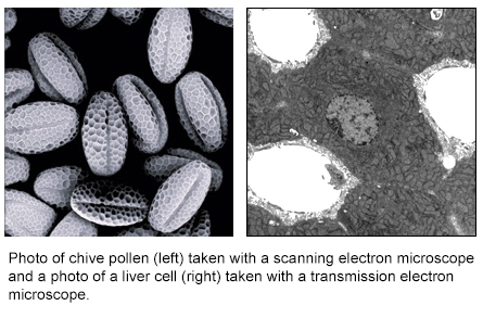 Photo of Chive Pollen (left). Photo (right) Liver Cell Photo of Chive Pollen (left). Photo (right) Liver Cell