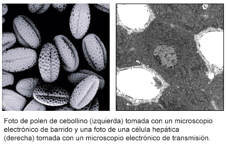 Foto de polen de cebollino (izquierda) tomada con un microscopio electrónico de barrido y una foto de una célula hepática (derecha) tomada con un microscopio electrónico de transmisión. Foto de polen de cebollino (izquierda) tomada con un microscopio electrónico de barrido y una foto de una célula hepática (derecha) tomada con un microscopio electrónico de transmisión.
