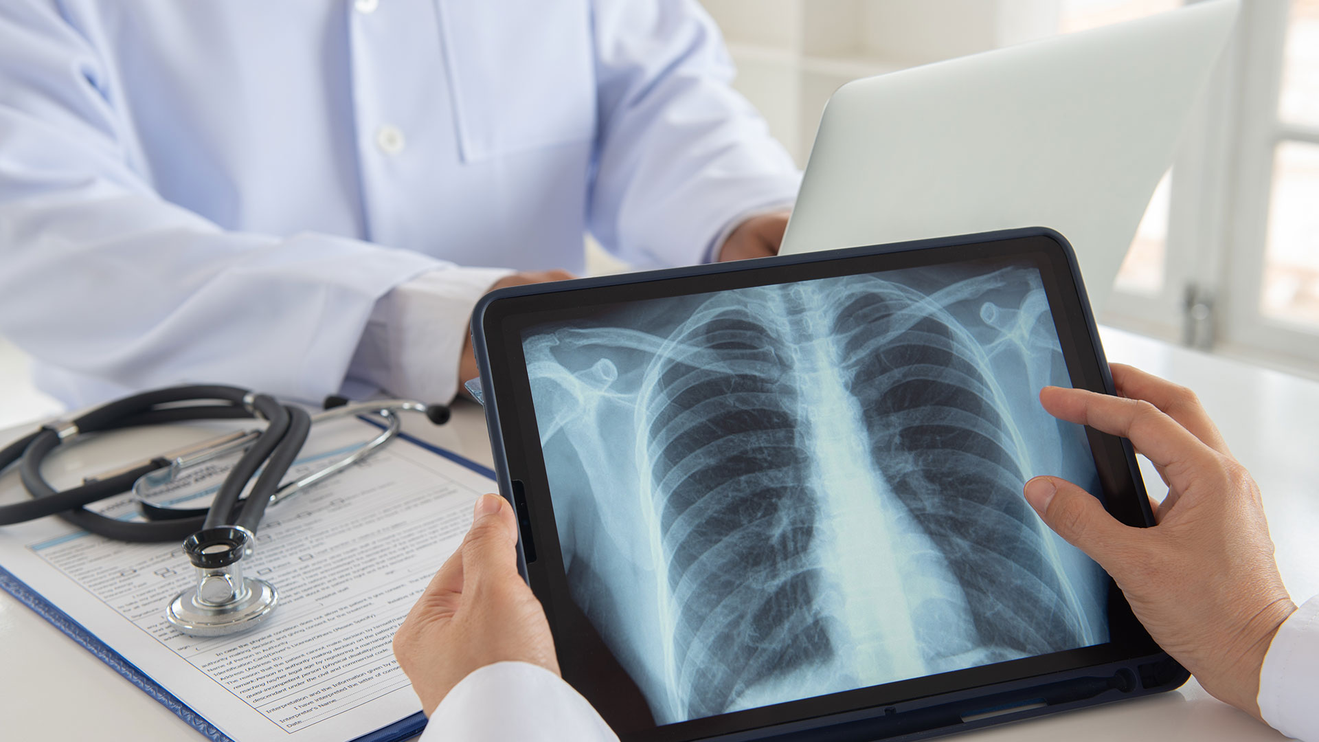 x-ray